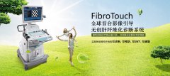  FibroTouch  影像引导无创肝纤维化诊断系统